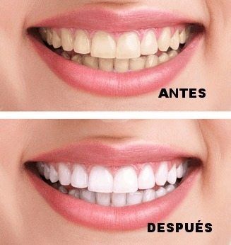 💜🌟CREMA DENTAL RESPLANDOR PURPLE SMILE V34 🌟👩‍🔬