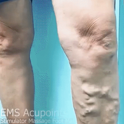 CUIDAMOS TU SALUD👩‍🔬 Estera de masaje para pies con estimulador de puntos de acupuntura EMS🫵