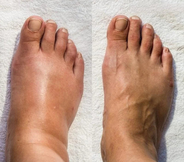 CUIDAMOS TU SALUD👩‍🔬 Estera de masaje para pies con estimulador de puntos de acupuntura EMS🫵